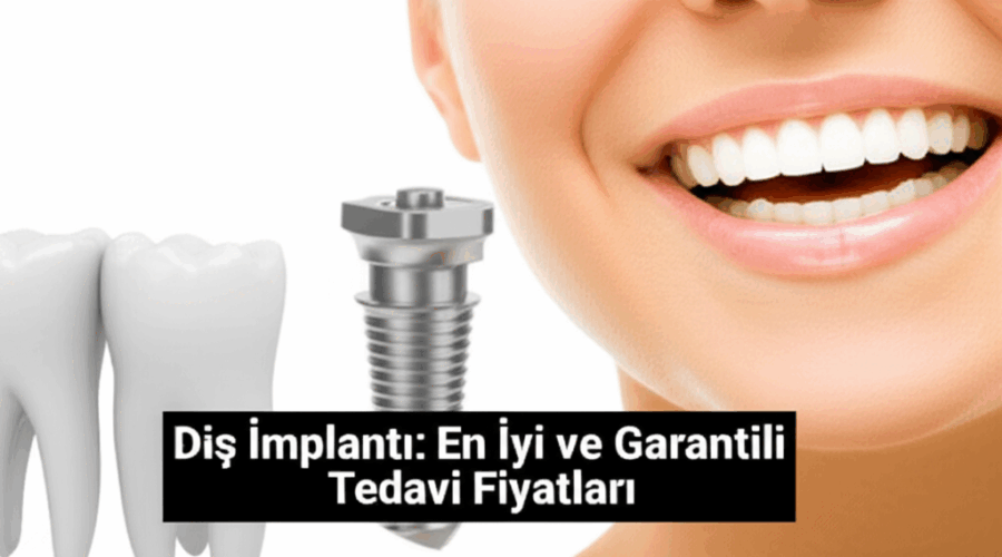 Diş İmplantı: En İyi ve Garantili Tedavi Fiyatları